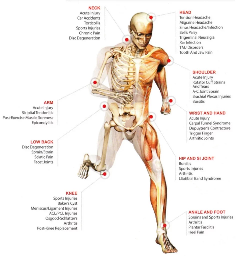 deep tissue laser therapy