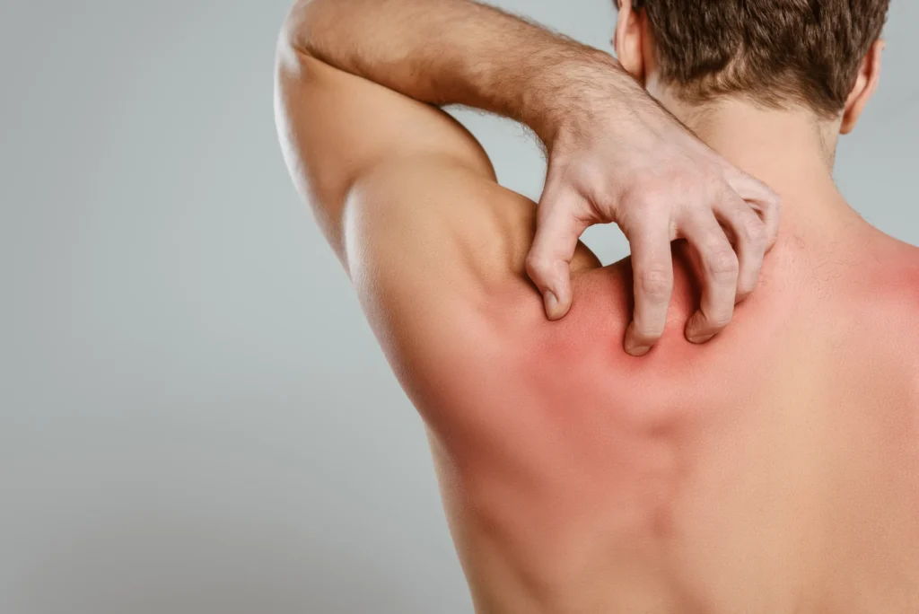 doctors who specialize in shingles near me
